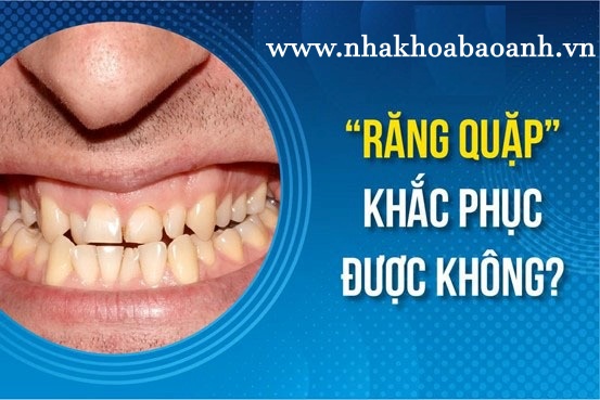 phuong-phap-phuc-hoi-rang-quap-vao-trong-hieu-qua