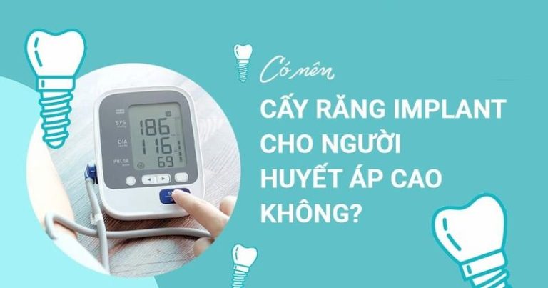 nguoi-bi-cao-huyet-ap-co-cay-implant-duoc-khong3