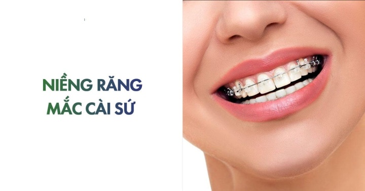 tim-hieu-thong-tin-ve-nieng-rang-mac-cai-su2